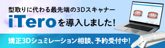 型取りに代わる最先端の3DスキャナーiTeroを導入しました！