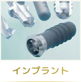 インプラント