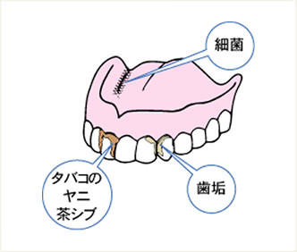 総入れ歯