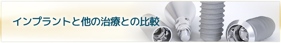 インプラントと他の治療との比較