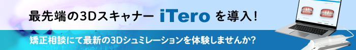 最先端の３DスキャナーiTeroを導入！矯正相談にて最新の３Dシュミレーションを体験しませんか？